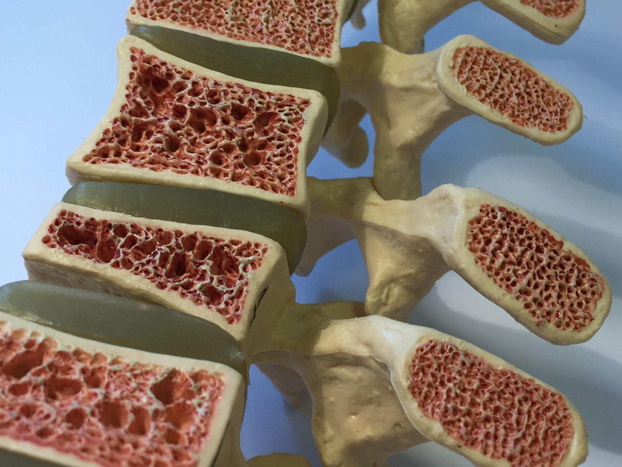 New Hormone CCN3 Could Revolutionize Bone Health Treatments