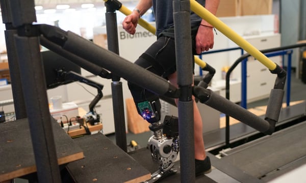 Brain-Controlled Bionic Leg Enhances Amputees' Mobility