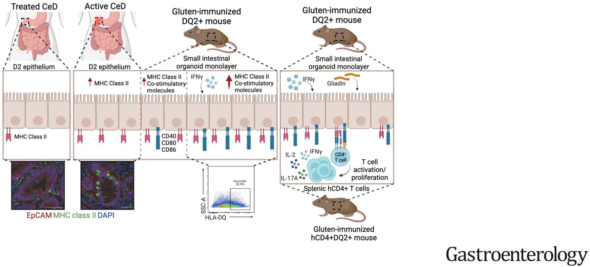 New Insights into Gluten's Role in Celiac Disease