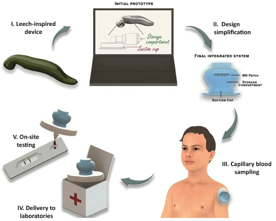 New Blood Sampling Device Inspired by Leeches Reduces Pain and Fear