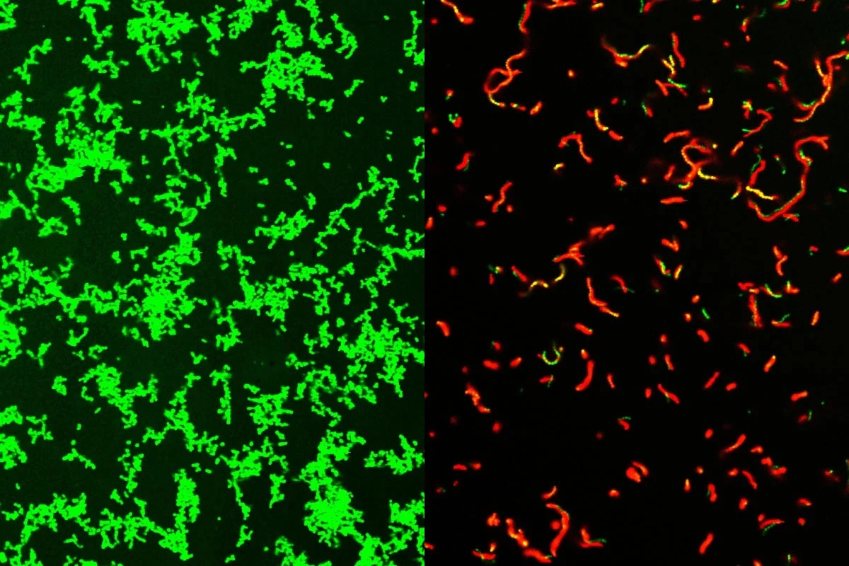 New Antibiotic Compound Shows Promise in Treating Severe Bacterial Infections