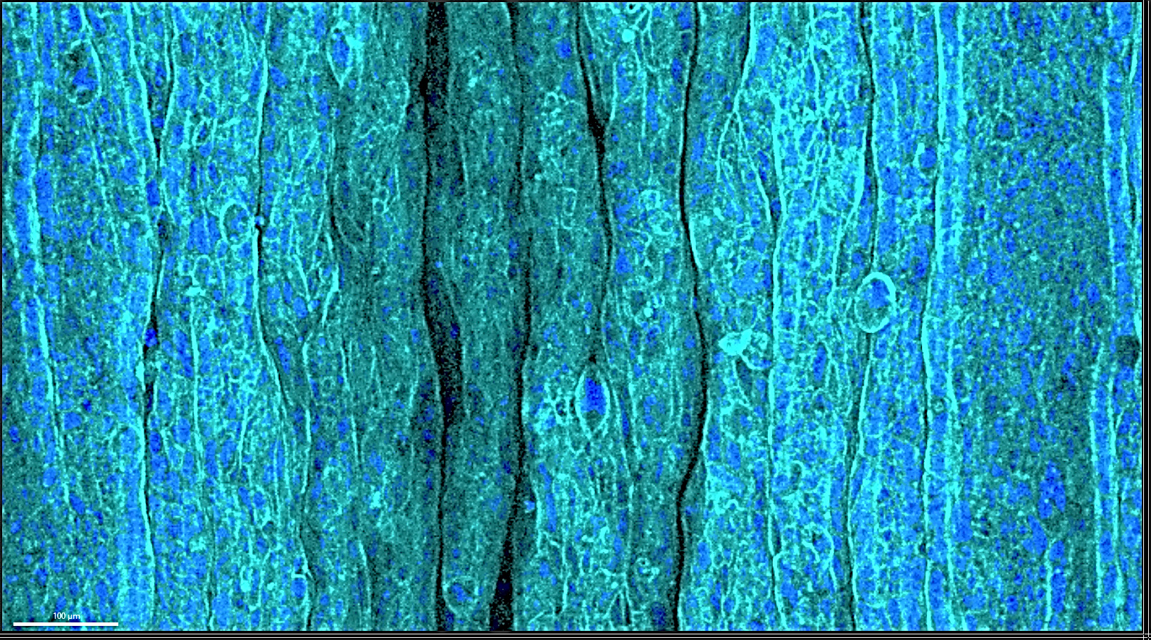 Pohang University of Science and Technology research reveals the principles of wrinkle formation.