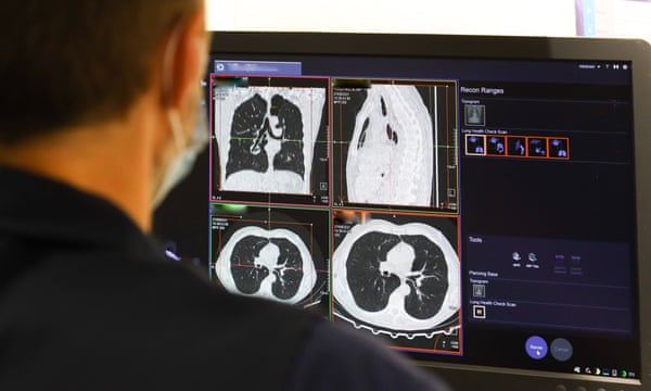 New Drug Combo Extends Lung Cancer Survival