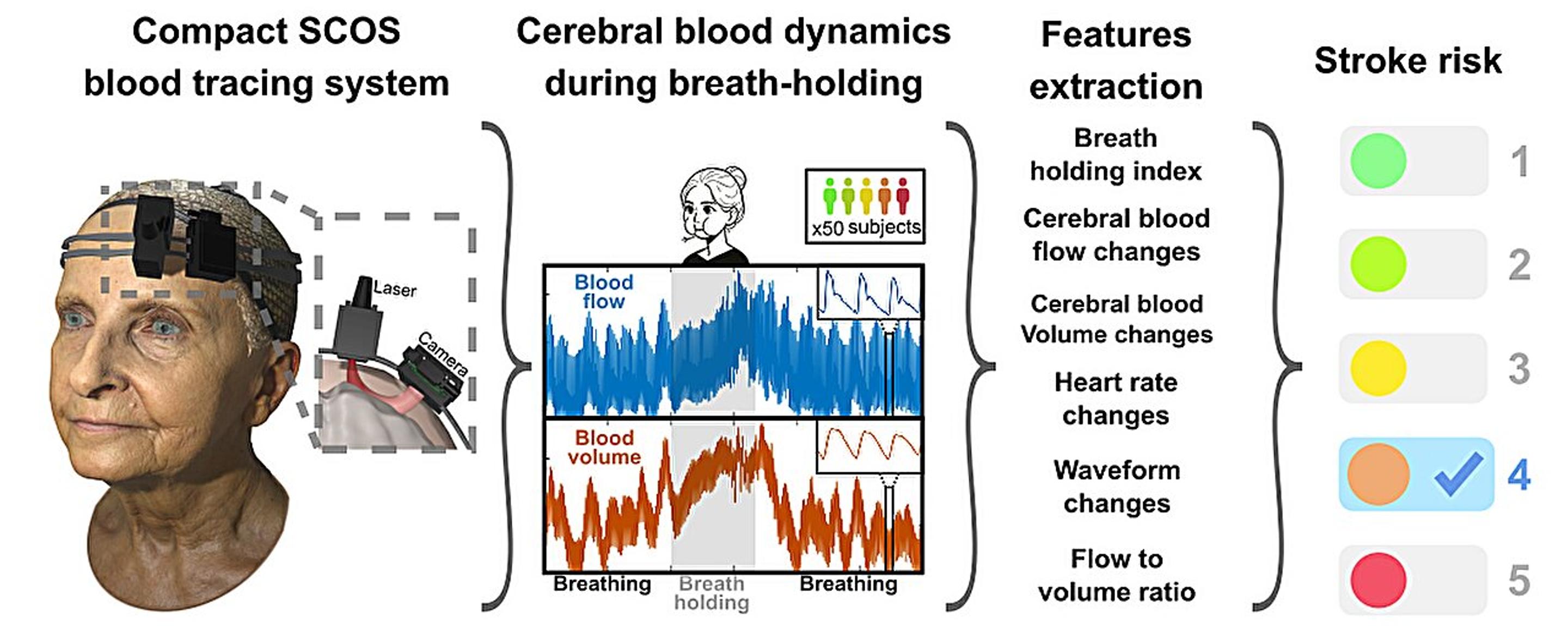 Non-invasive laser device for real-time identification of stroke risk