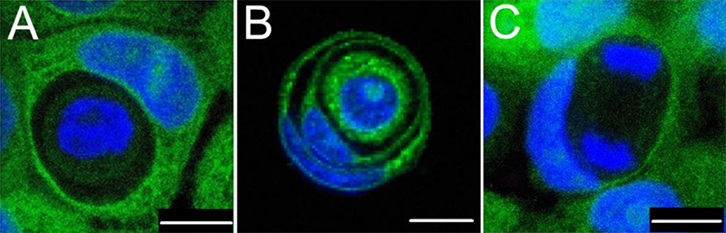 Understanding the Diverse Modes of Cell Death in the Human Body