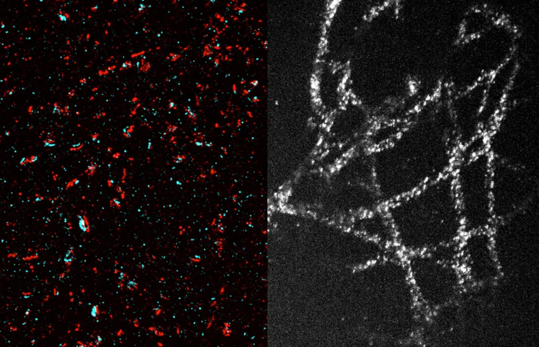 MIT Develops Cost-Effective Nanoscale Imaging Technique for Standard Microscopes