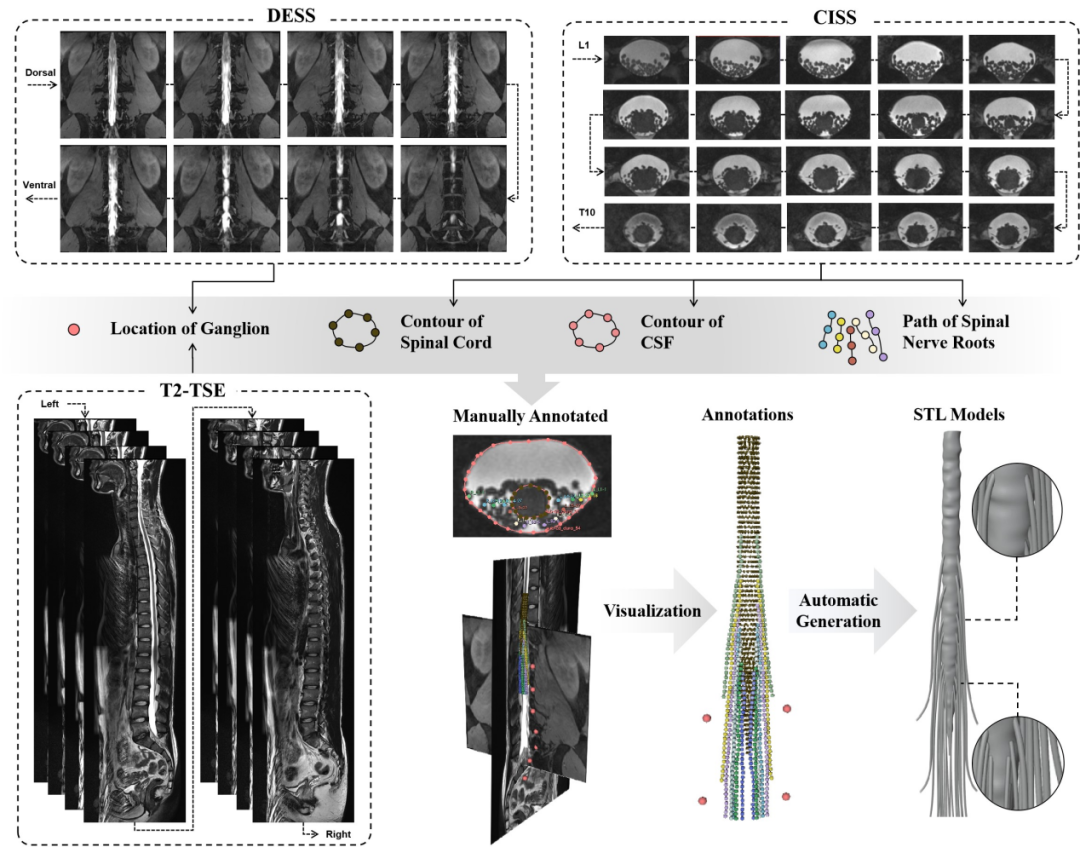 Fudan team develops next-generation brain-spinal interface device, offering hope for paralyzed patients to regain walking ability.